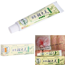 15g Psoriasis Dermatitis Eczema Treatment Anti Bacterial Skin Fungus Herbal Cream Ointment Miao J4U66