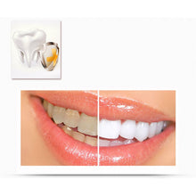 2ml Transparent White Teeth High Strength Whitening Gel Pen Whitener Tooth Pen Dental Equipment LE2 J4U66