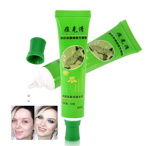30g Acne Cream Blain Products Desalt Blain To Imprint Face Cream Face Treatment J4U66
