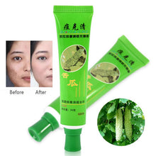30g Acne Cream Blain Products Desalt Blain To Imprint Face Cream Face Treatment J4U66