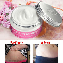 pregnancy repaircream stretch mark remover maternity relieve fat grain skin care J4U66