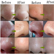 skin care suction black mask bamboo charcoal blackhead remover nose face facial mask tearing peeling shrink pores J4U66