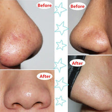 Face Mask Suction Black Head Peel Masks Deep Cleansing Tearing Blackhead Remover Purifying J4U66