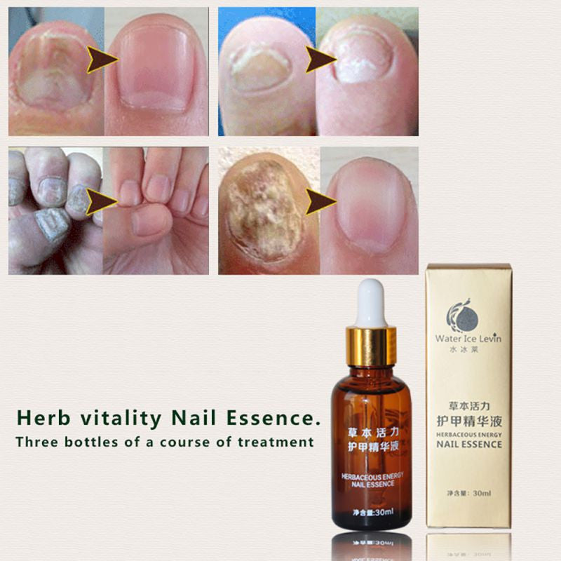 health skin care herbal nail repair treatment essential oil onychomycosis remover serum beauty disinfect J4U66