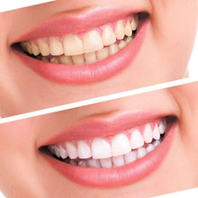 Teeth Whitening 44% Peroxide Dental Bleaching System Oral Gel Kit Tooth Whitener Dental Equipment J4U66