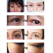 30g Anti-Dark Circle Wrinkle Anti Puffiness Wrinkles Gold Snail Repair Eye Cream J4U66