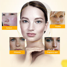 women face skin whitening remove freckle speckle peel dark spot wrinkles cream J4U66