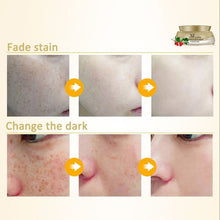 women face skin whitening remove freckle speckle peel dark spot wrinkles cream J4U66